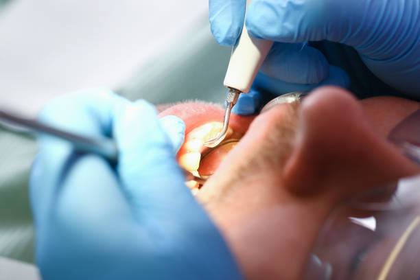 Best Emergency Treatment for Toothache in Edinburg, IL